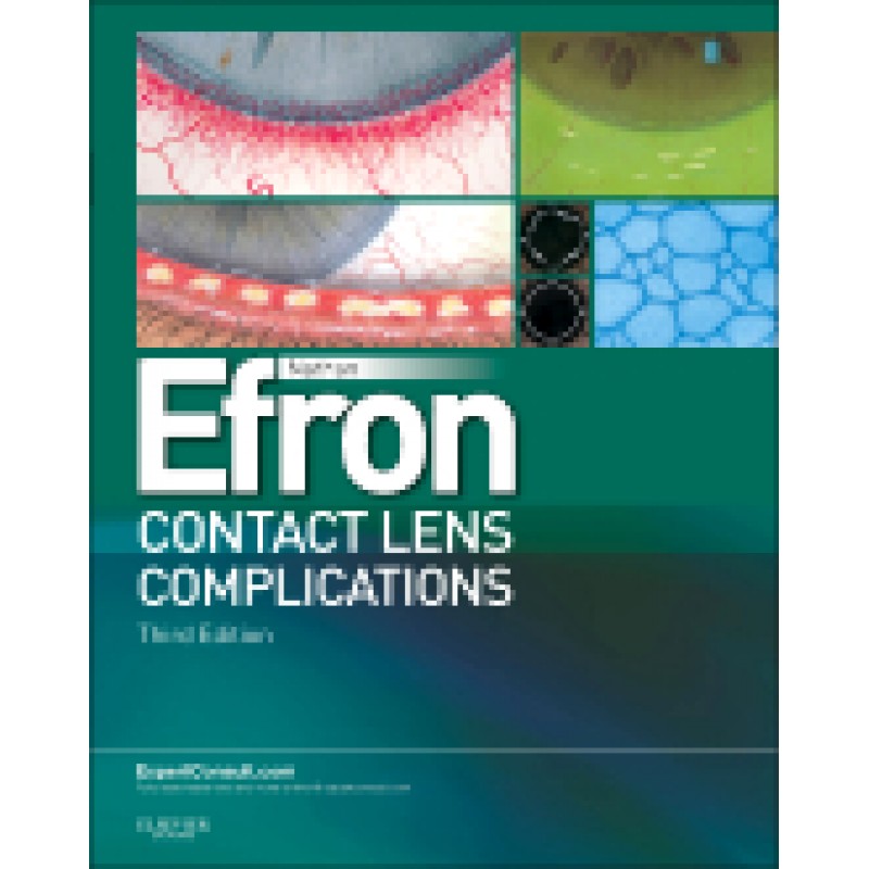 Contact Lens Complications, 3rd Edition - Expert Consult - Online and Print